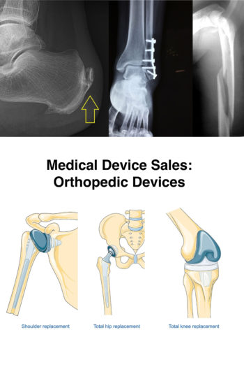 Cover image for Orthopedic Medical Devices